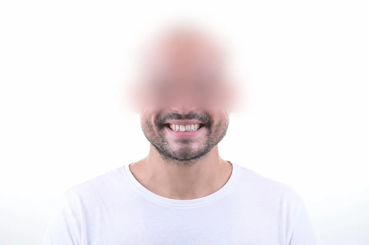 Natural smile