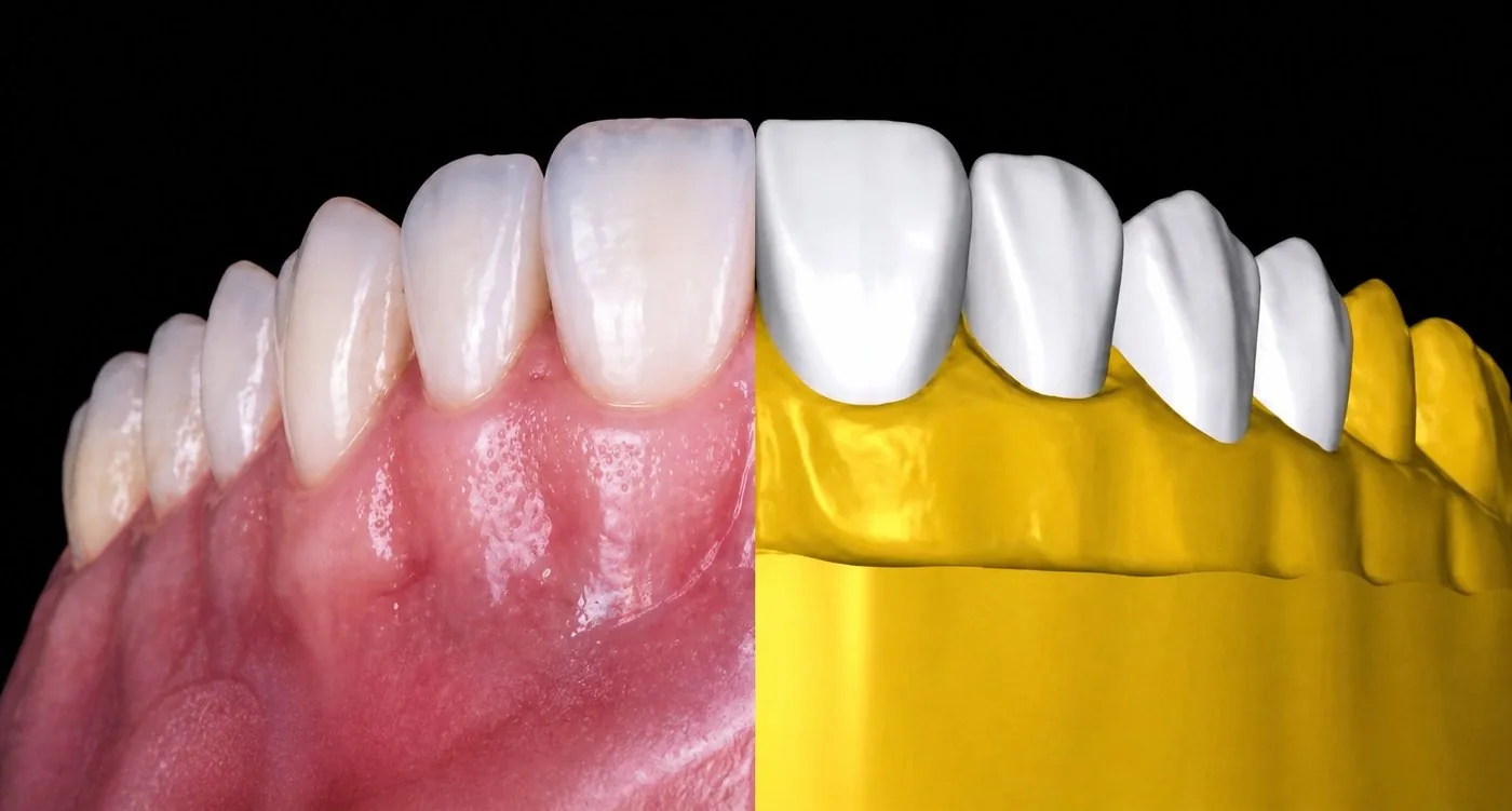 Actual vs 3D comparison, symbolic 2D vs 3D illustration