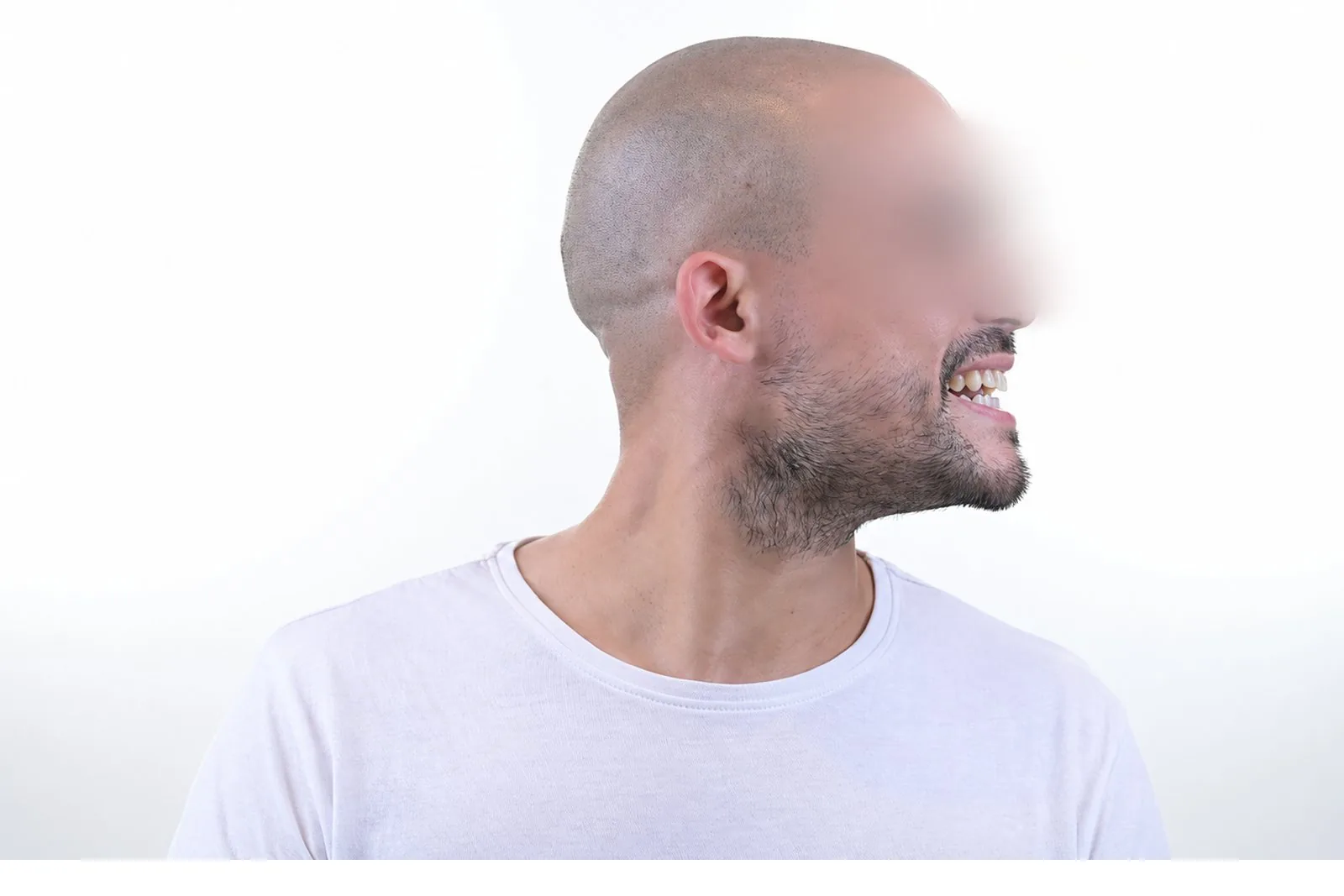Three-quarter view of the face