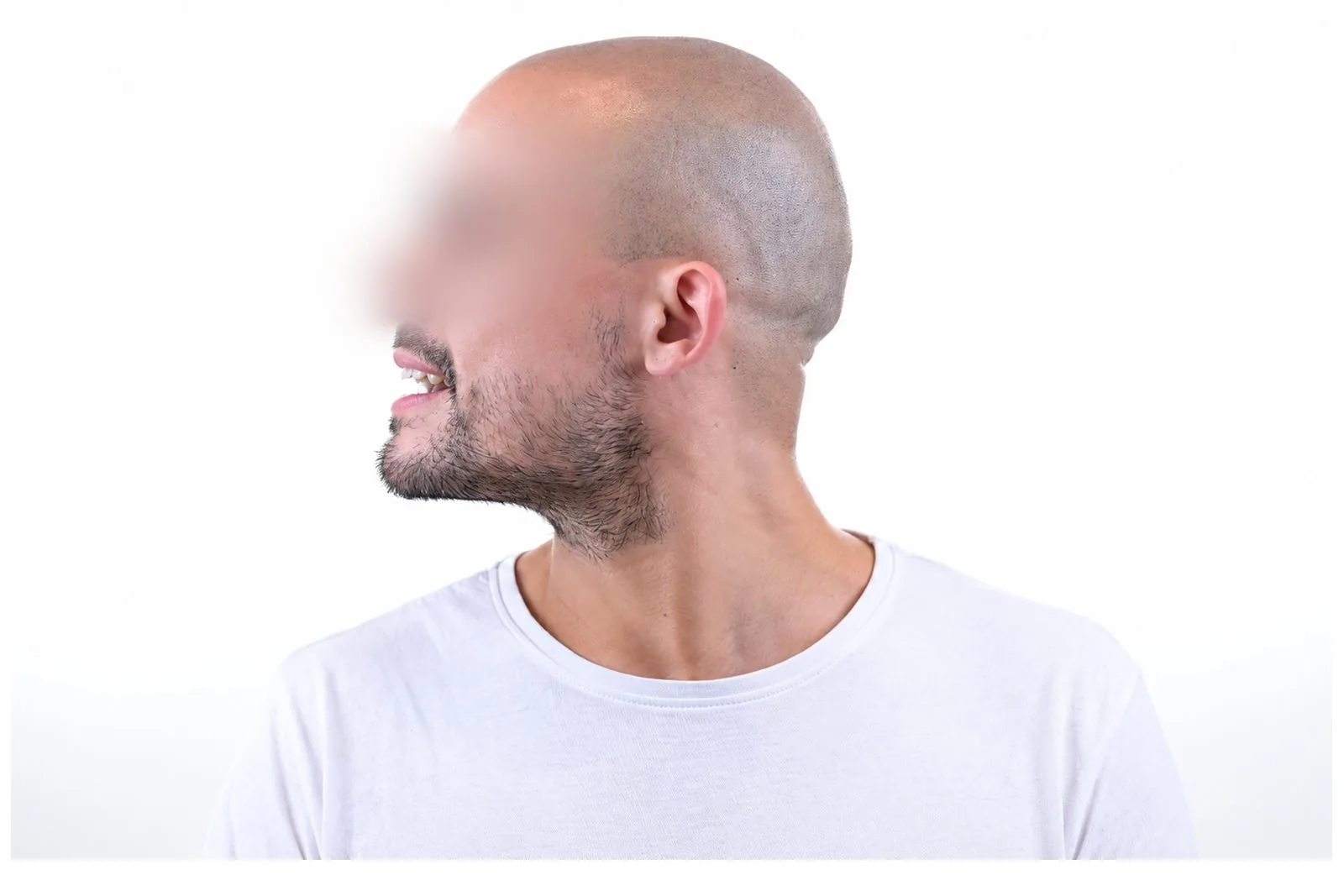 Three-quarter view, symmetrical face
