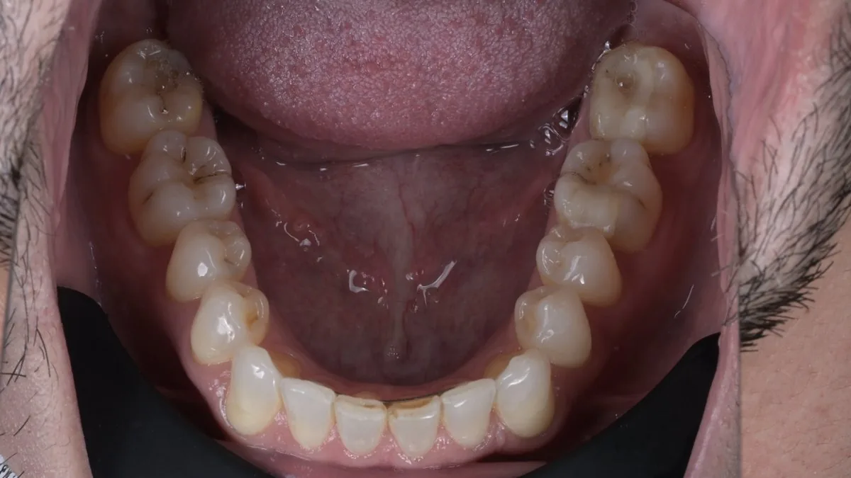 Dental arch 1