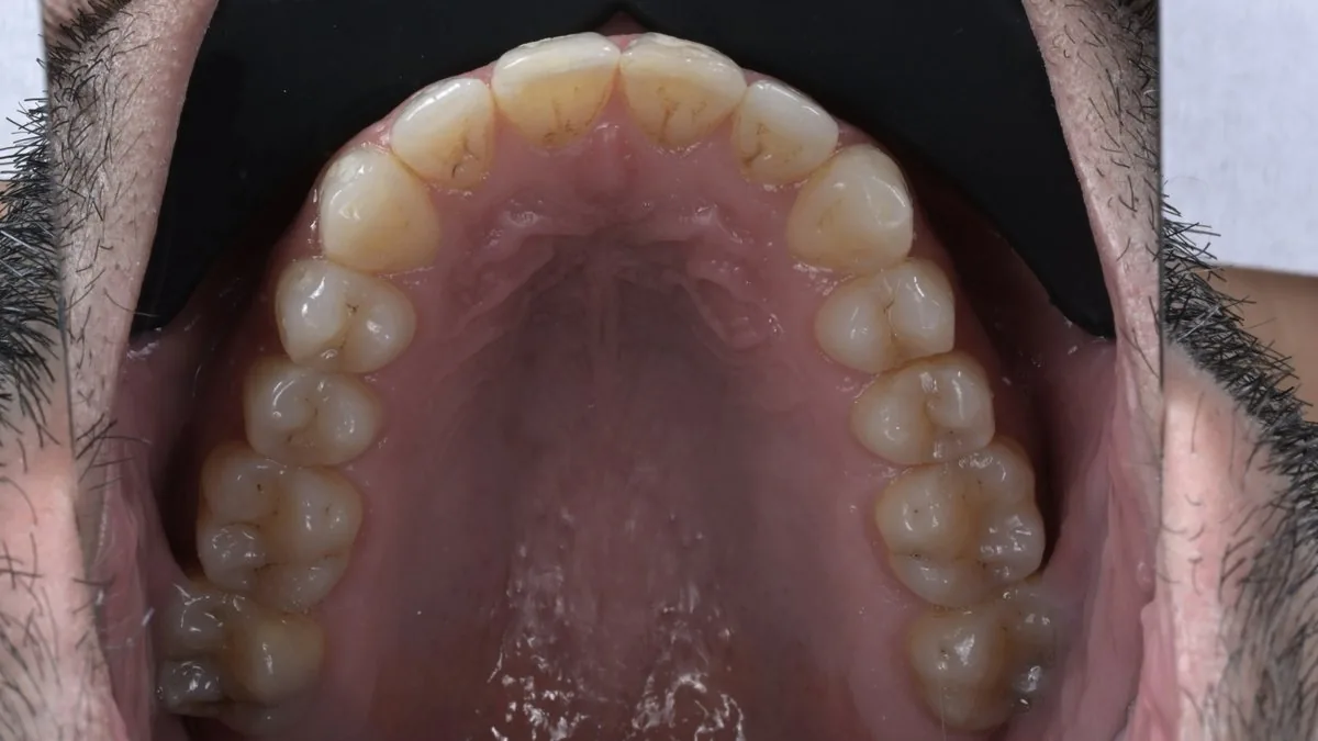 Dental arch 2