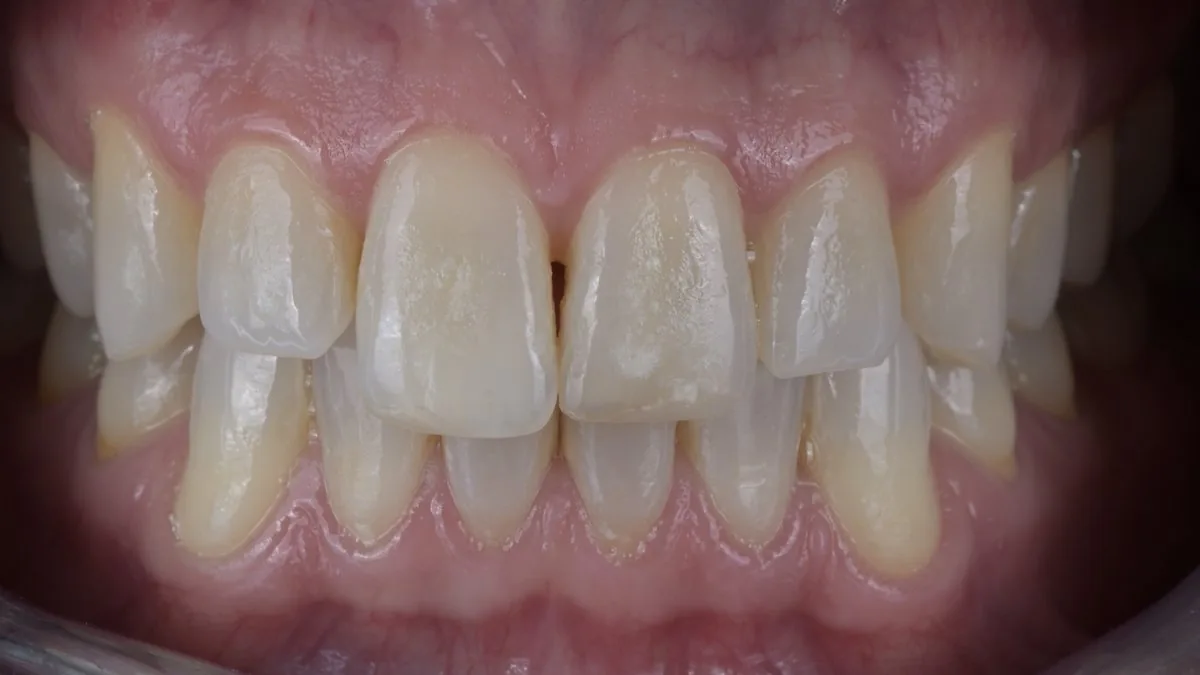 Dental macro photograph